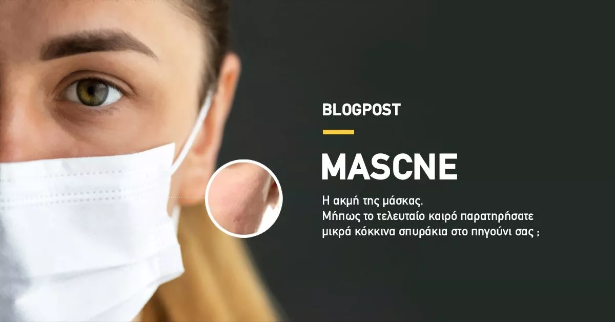 Mascne